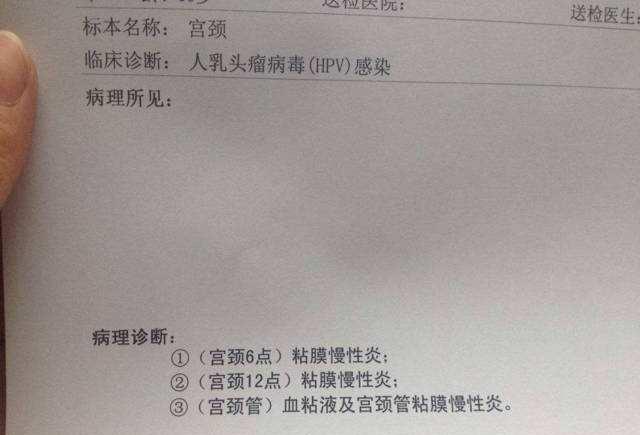 宮頸有問題的前兆，了解并預防宮頸健康風險，宮頸健康風險預警，預防宮頸問題，了解前兆與措施