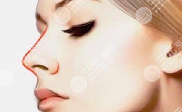 整容鼻子能否保持一輩子？深度解析鼻子整容的持久性，深度解析，鼻子整容的持久性——能否保持一輩子？