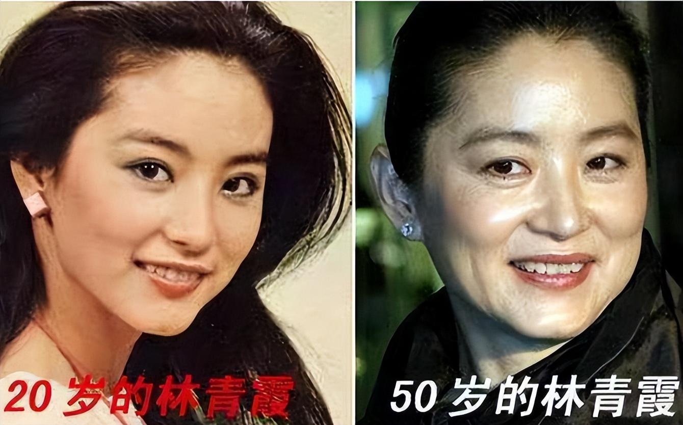 整容的明星女對比，美麗背后的故事，整容明星女對比，美麗背后的故事揭秘