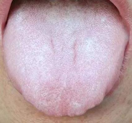 喉嚨感覺有東西堵著是怎么回事，解析癥狀與原因，喉嚨感覺有東西堵著的原因及癥狀解析