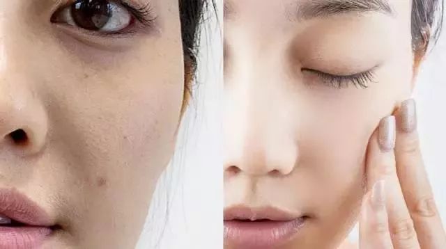 如何讓皮膚快速變白——全方位美白指南，全方位美白指南，實現(xiàn)皮膚快速變白的秘訣與技巧