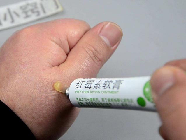 紅霉素軟膏能治療外陰白斑嗎？解析與指導(dǎo)，紅霉素軟膏能否治療外陰白斑？詳解及指導(dǎo)建議