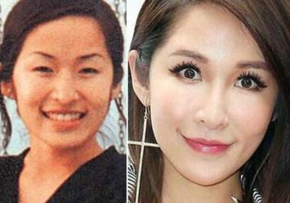 她是整容最成功的女明星之一，整容背后的故事與啟示，整容成功背后的女星故事，啟示與反思